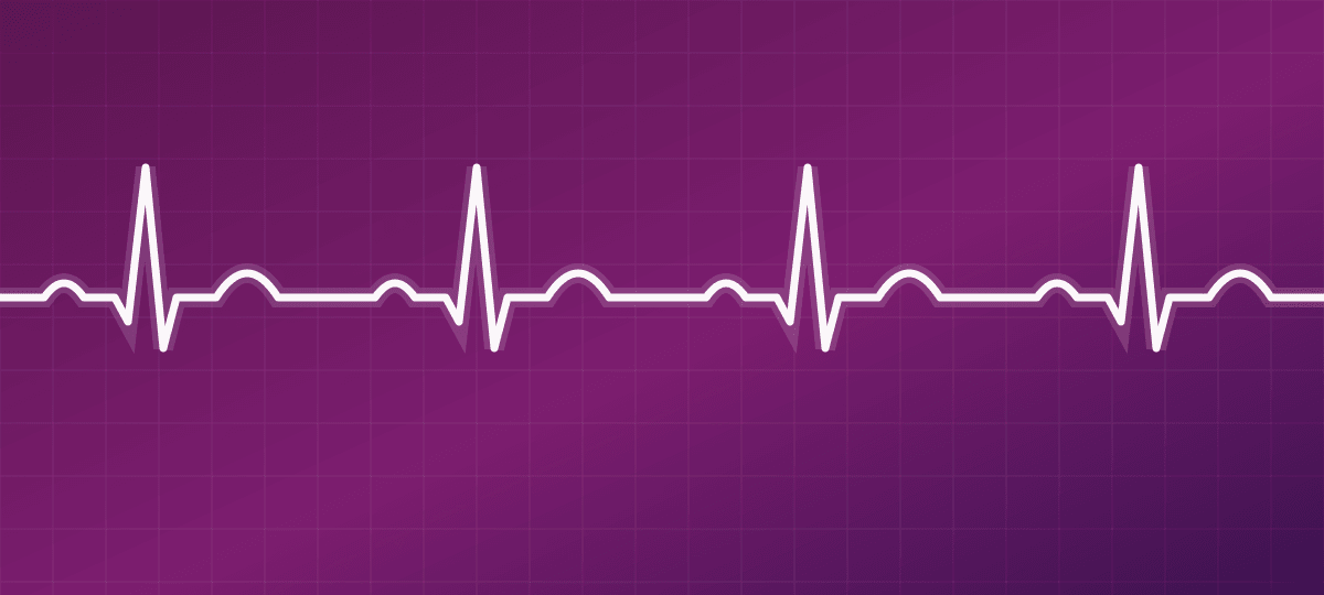 ECG
